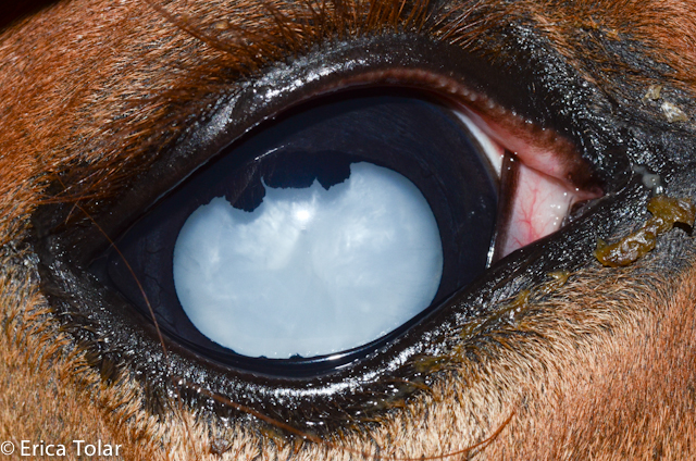 Cataract