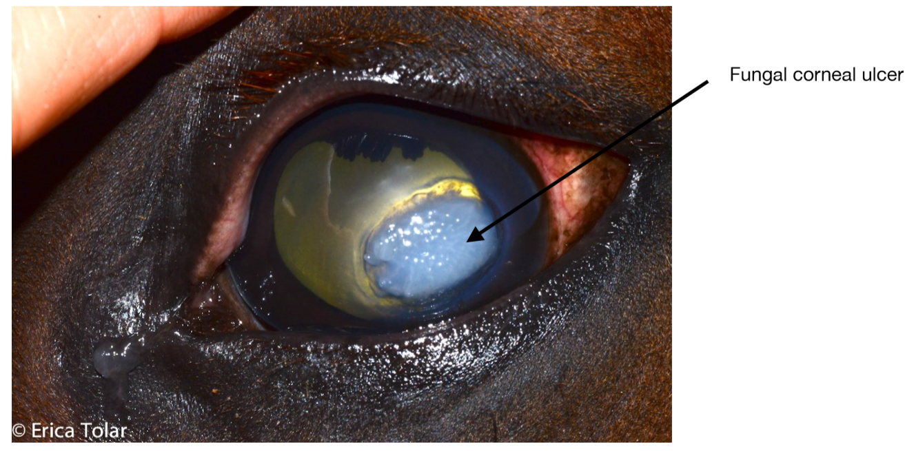 Fungal Corneal Ulcer