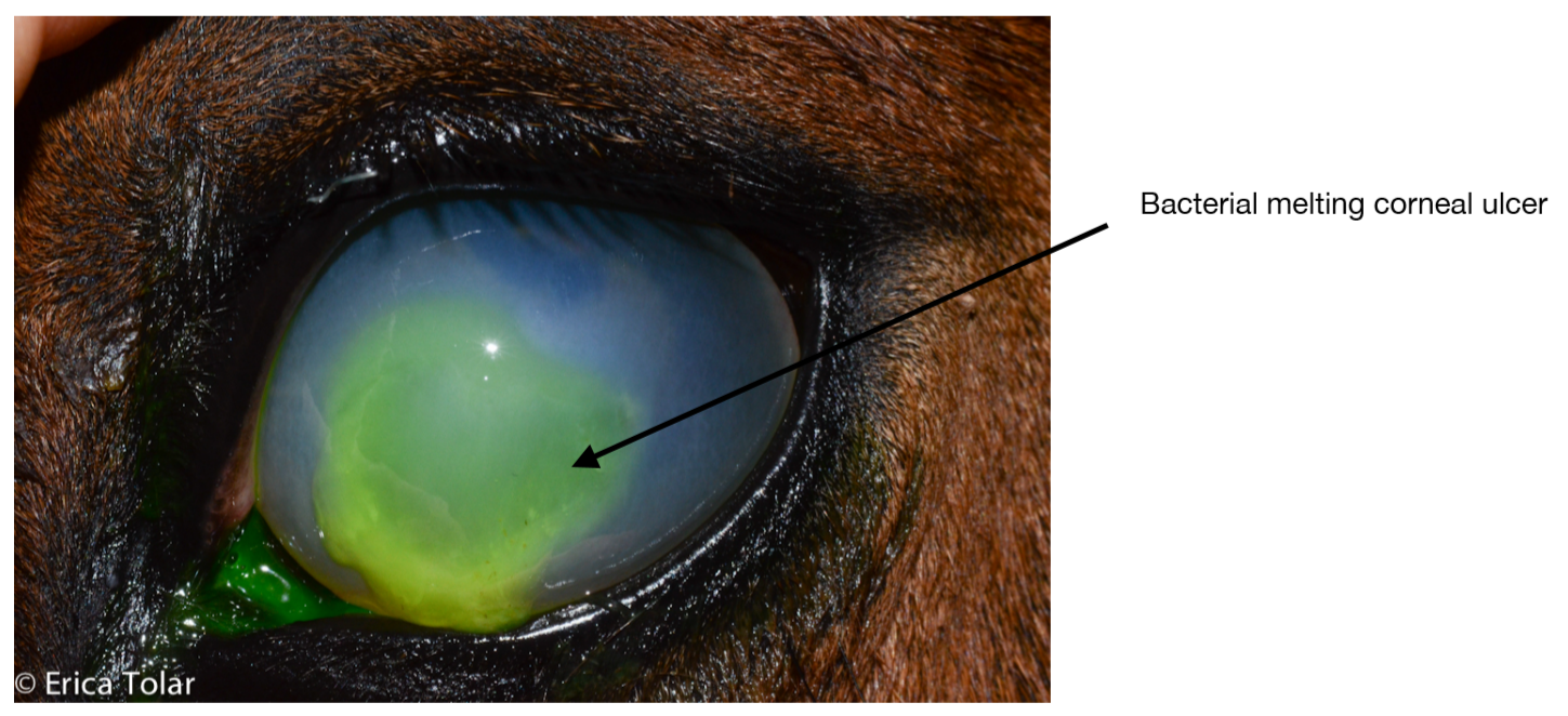 Bacterial Melting Corneal Ulcer