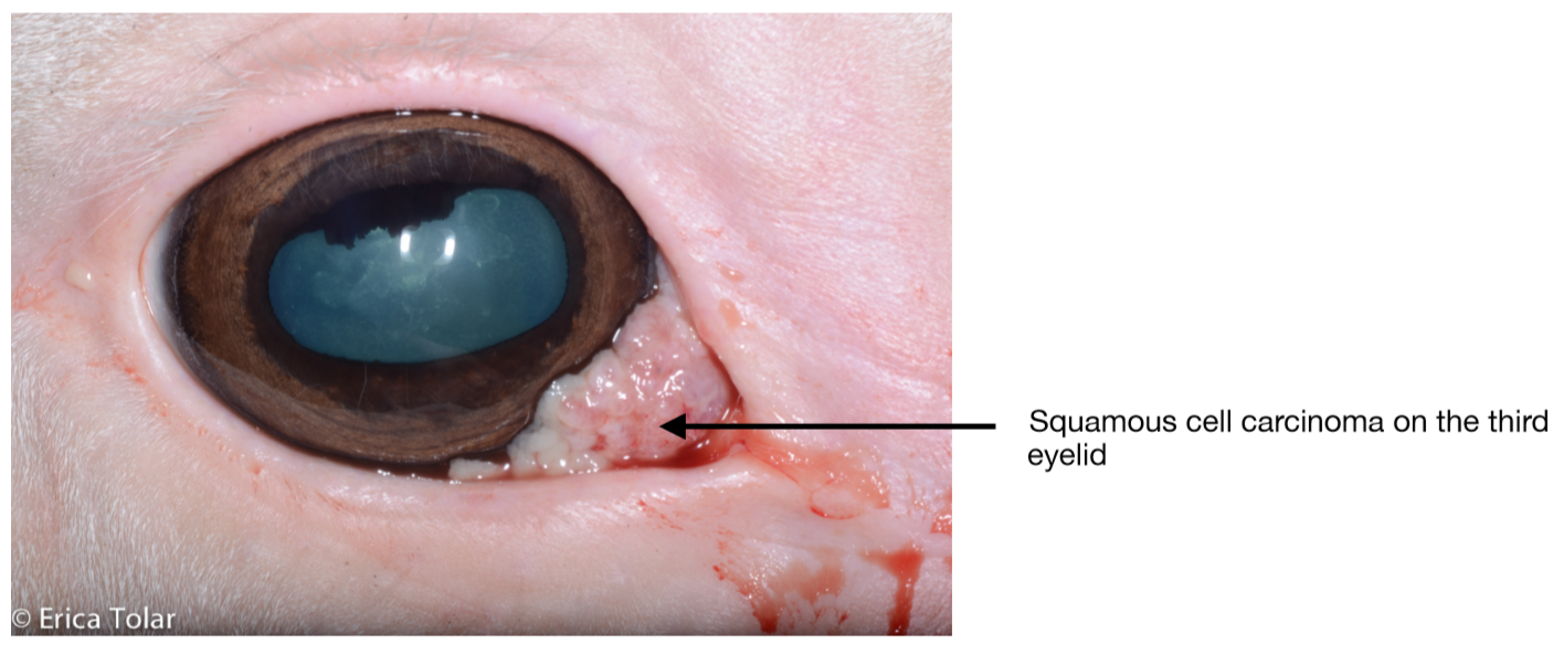 Squamous Cell Carcinoma