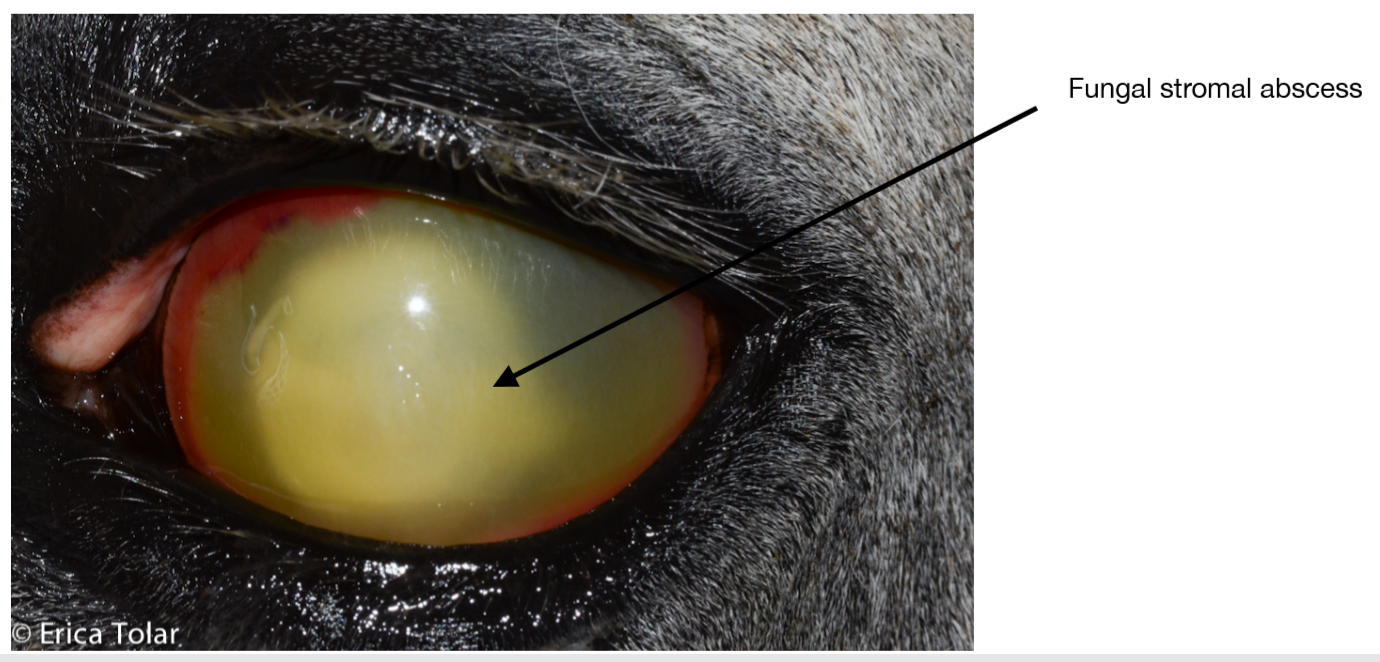 Fungal Stromal Abscess