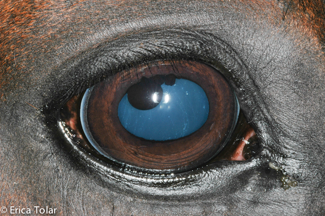 Corpora Nigra Cyst