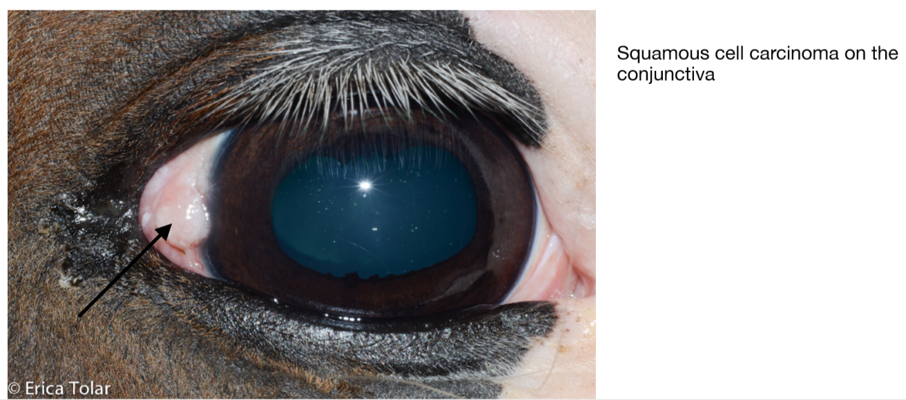 Squamous Cell Carcinoma