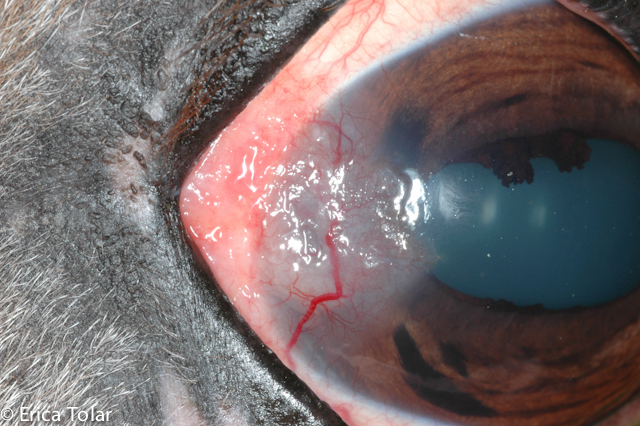 Squamous Cell Carcinoma
